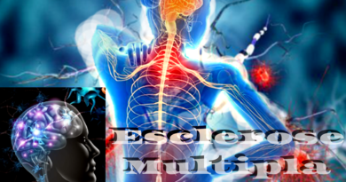 Esclerose Multipla